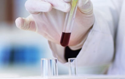 Solvents for Clinical Analysis